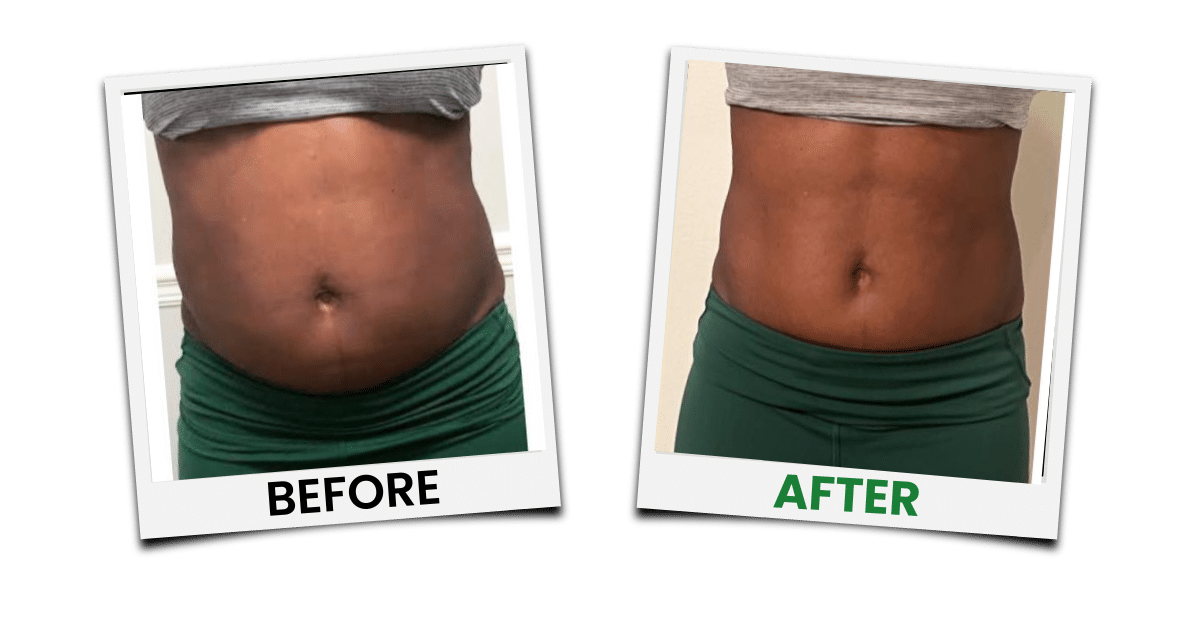Before-and-after treatment example