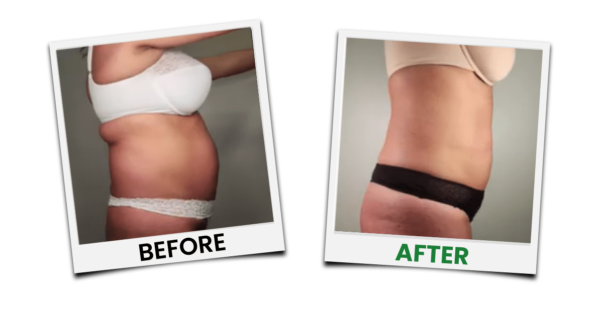 Before-and-after treatment example