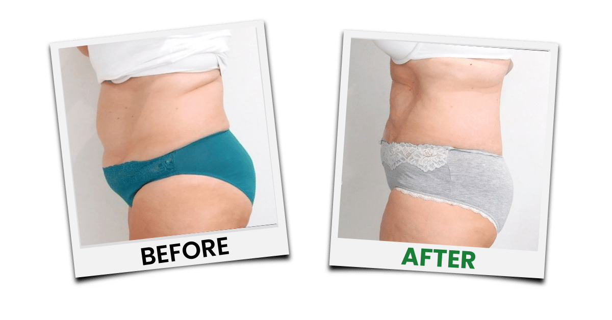 Before-and-after treatment example